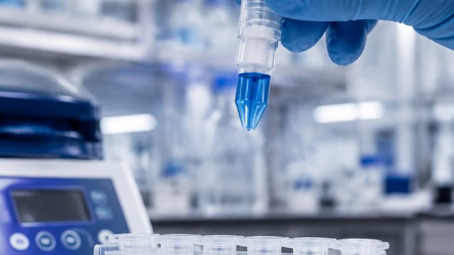 Key Insights into the North American Buffer Exchange Spin Columns Market | data pengeluaran singapur