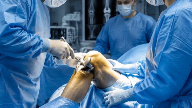 Transforming Orthopedic Surgery: The Shift to Bundled Payments
